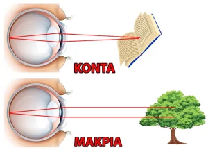 μεθοδος monovision